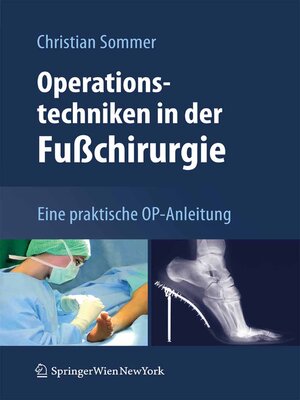 cover image of Operationstechniken in der Fußchirurgie